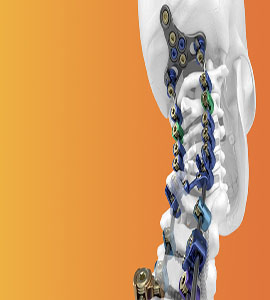 Spinal and orthopedic implants displayed in a clinical setting
