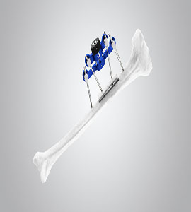 Spinal and orthopedic implants displayed in a clinical setting